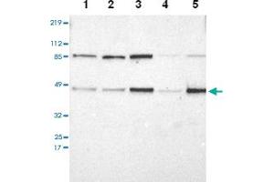 Western blot analysis of Lane 1: RT-4, Lane 2: U-251 MG, Lane 3: A-431, Lane 4: Liver, Lane 5: Tonsil with IRF9 polyclonal antibody at 1:250-1:500 dilution. (IRF9 抗体)