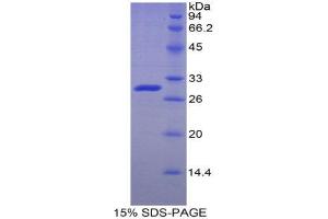 SDS-PAGE (SDS) image for Adenosine Kinase (ADK) (AA 94-339) protein (His tag) (ABIN1878005)