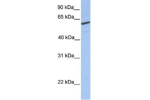 WB Suggested Anti-RFT1 Antibody Titration: 0. (RFT1 抗体  (N-Term))