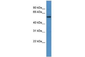 WB Suggested Anti-Papd4 Antibody Titration:  0. (PAPD4 抗体  (C-Term))