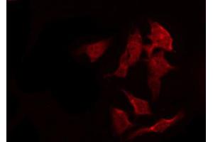 ABIN6267261 staining SK-OV3 by IF/ICC. (EGFR 抗体  (pSer1070))