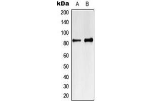 Western blot analysis of MARK4 expression in Jurkat (A), K562 (B) whole cell lysates. (MARK4 抗体  (Center))