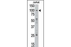 Western blot analysis of anti-MLLT10 Pab in Jurkat cell line lysate. (MLLT10 抗体  (C-Term))