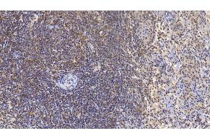 Detection of VF in Human Spleen Tissue using Monoclonal Antibody to Visfatin (VF) (NAMPT 抗体  (AA 1-491))