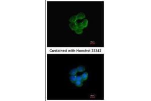 ICC/IF Image Immunofluorescence analysis of methanol-fixed A431, using NNT, antibody at 1:200 dilution. (NNT 抗体  (C-Term))