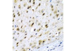 Immunohistochemistry of paraffin-embedded mouse brain using TPH2 antibody (ABIN5974298) at dilution of 1/200 (40x lens). (Tryptophan Hydroxylase 2 抗体)