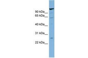 Image no. 1 for anti-CDNA Sequence BC051142 (BC051142) (C-Term) antibody (ABIN6742069) (CDNA Sequence BC051142 (BC051142) (C-Term) 抗体)