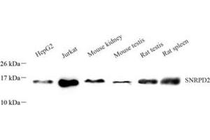 Western blot analysis of SNRPD2 (ABIN7075634) at dilution of 1: 1000 (SNRPD2 抗体)