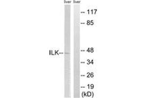 Western blot analysis of extracts from rat liver cells, using ILK (Ab-246) Antibody. (ILK 抗体  (AA 212-261))