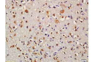Formalin-fixed and paraffin embedded mouse brain labeled with Anti-Bid Polyclonal Antibody, Unconjugated  at 1:200 followed by conjugation to the secondary antibody and DAB staining (BID 抗体  (AA 102-195))