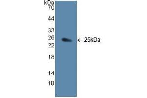 Western blot analysis of recombinant Human JAG1. (JAG1 抗体  (AA 836-1047))