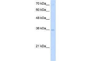 WB Suggested Anti-PRIM2 Antibody Titration:  5. (PRIM2 抗体  (Middle Region))