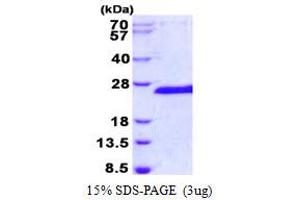 Image no. 2 for E3 Ubiquitin-Protein Ligase SIAH1 (SIAH1) (AA 90-282) protein (His tag) (ABIN1098362)