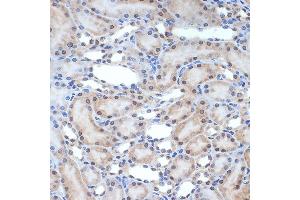 Immunohistochemistry of paraffin-embedded rat kidney using XPD/ERCC2 Rabbit mAb (ABIN7267057) at dilution of 1:100 (40x lens). (ERCC2 抗体)