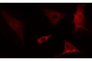 ABIN6275702 staining  COLO205 cells by IF/ICC. (SLC39A4 抗体  (Internal Region))