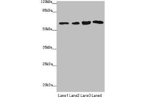 Western blot All lanes: FBXO7 antibody at 3.