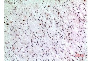 Immunohistochemistry (IHC) analysis of paraffin-embedded Human Brain, antibody was diluted at 1:100. (P57 (Ser24) 抗体)
