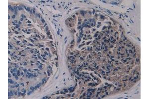 Used in DAB staining on fromalin fixed paraffin- embedded kidney tissue (LSR 抗体  (AA 335-589))