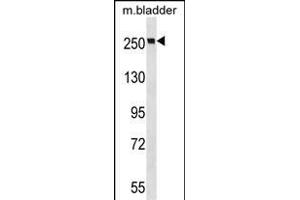 MYH9 Antibody (N-term ) (ABIN6243267 and ABIN6577348) western blot analysis in mouse bladder tissue lysates (35 μg/lane). (Myosin 9 抗体  (N-Term))