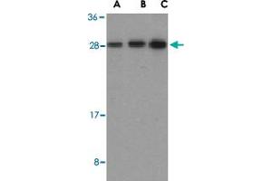 Western blot analysis of BID in mouse lung tissue lysates with BID polyclonal antibody  at (A) 0.