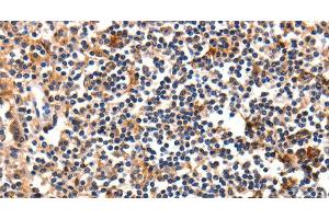 Immunohistochemistry of paraffin-embedded Human tonsil using FADD Polyclonal Antibody at dilution of 1:35 (FADD 抗体)