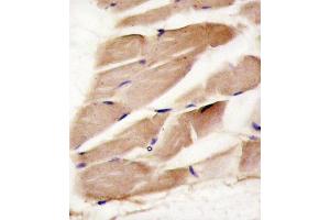 Formalin-fixed and paraffin-embedded human skeletal muscle reacted with PRK antibody (C-term) (ABIN391608 and ABIN2841530) , which was peroxidase-conjugated to the secondary antibody, followed by DAB staining. (PRKAA2 抗体  (C-Term))