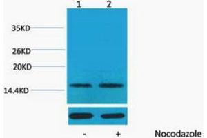 Western Blotting (WB) image for anti-Histone H1 (pThr17) antibody (ABIN3181350) (Histone H1 抗体  (pThr17))