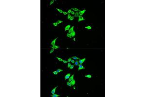Immunofluorescence analysis of A549 cell using CD55 antibody. (CD55 抗体)