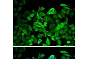 Immunofluorescence analysis of HeLa cells using ANXA1 Polyclonal Antibody (Annexin a1 抗体)