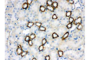 Immunohistochemistry (IHC) image for anti-Cytochrome P450, Family 1, Subfamily B, Polypeptide 1 (CYP1B1) (AA 255-480) antibody (ABIN3042785)