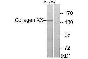 Western Blotting (WB) image for anti-Collagen, Type X, alpha 1 (COL10A1) (C-Term) antibody (ABIN1850314)
