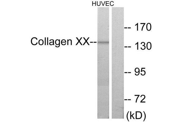 COL10A1 抗体  (C-Term)