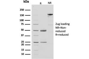 SDS-PAGE Analysis Purified CKBB Mouse Monoclonal Antibody (CPTC-CKB-2). (CKB 抗体)