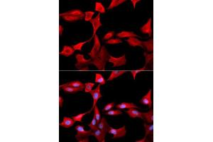 Immunofluorescence analysis of U2OS cells using GCLM antibody. (GCLM 抗体  (AA 1-274))