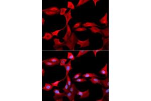 Immunofluorescence analysis of U2OS cells using GCLM antibody. (GCLM 抗体  (AA 1-274))