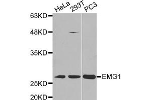 Western Blotting (WB) image for anti-EMG1 Nucleolar Protein Homolog (EMG1) antibody (ABIN1875902) (EMG1 抗体)