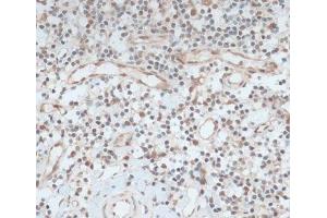 Immunohistochemistry (Paraffin-embedded Sections) (IHC (p)) image for anti-Zinc Finger Protein 416 (ZNF416) antibody (ABIN7258204)