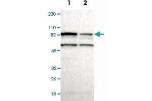 Western Blot analysis of Lane 1: RT-4 and Lane 2: U-251MG sp cell lysates with RPS6KA6 polyclonal antibody .