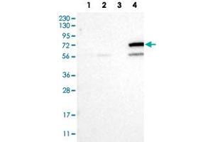 Western Blot analysis of Lane 1: RT-4 cell, Lane 2: U-251 MG sp cell, Lane 3: human plasma tissue (IgG/HSA depleted) and Lane 4: human liver tissue lysates with CYP4F11 polyclonal antibody . (CYP4F11 抗体)
