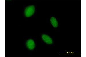 Immunofluorescence of purified MaxPab antibody to ASXL2 on HeLa cell. (ASXL2 抗体  (AA 1-918))