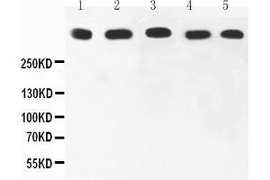 Anti-Ki67 Picoband antibody, All lanes: Anti-Ki67 at 0. (Ki-67 抗体  (AA 2860-3256))