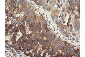 Image no. 1 for anti-Breast Cancer Anti-Estrogen Resistance 1 (BCAR1) antibody (ABIN1496834) (BCAR1 抗体)