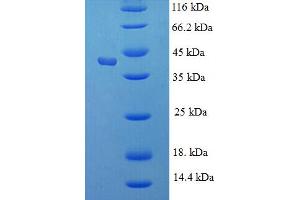 SDS-PAGE (SDS) image for Kallikrein 1 (KLK1) (AA 25-262) protein (His-SUMO Tag) (ABIN5709809)