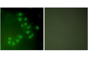 Immunofluorescence analysis of A549 cells, using p63 Antibody. (TCP1 alpha/CCTA 抗体  (AA 631-680))