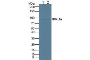 Western blot analysis of (1) Human U87-MG Cells and (2) Mouse Testis Tissue. (PNPLA2 抗体  (AA 484-701))