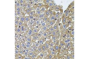 Immunohistochemistry of paraffin-embedded mouse liver using CETP antibody. (CETP 抗体  (AA 300-493))