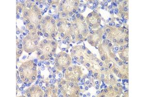 Immunohistochemistry of paraffin-embedded Rat kidney using ACY1 Polyclonal Antibody at dilution of 1:100 (40x lens). (Aminoacylase 1 抗体)
