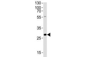 Western blot analysis of lysate from rat liver tissue lysate using Olig3 antibody at 1:1000. (OLIG3 抗体  (AA 70-103))