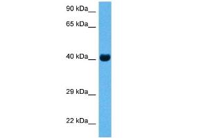 Host:  Rabbit  Target Name:  CKM  Sample Tissue:  Mouse Skeletal Muscle  Antibody Dilution:  1ug/ml (CKM 抗体  (N-Term))