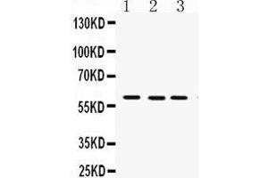 Western Blotting (WB) image for anti-Flavin Containing Monooxygenase 3 (FMO3) (AA 404-433), (C-Term) antibody (ABIN3043830) (FMO3 抗体  (C-Term))
